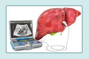 سونوگرافی کبد چرب